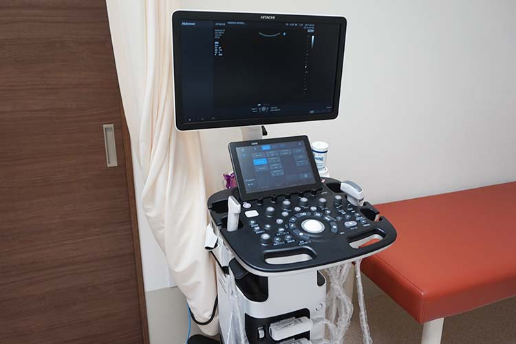 超音波検査装置