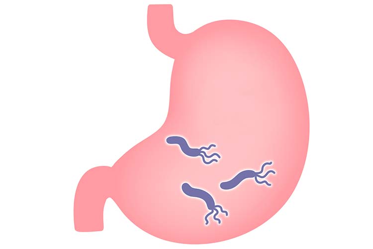 ピロリ菌のイメージ写真